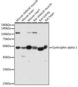 Syntrophin alpha 1 Rabbit anti-Human, Mouse, Rat, Polyclonal, Novus Biologicals 20 &mu;g | Buy Online | Novus Biologicals | Fisher Scientific