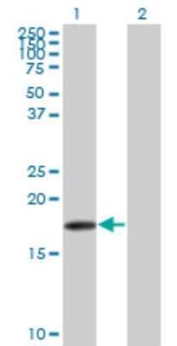 beta-Synuclein Antibody (3H4), Novus Biologicals 0.1 mg | Buy Online | Novus Biologicals | Fisher Scientific