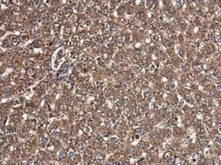 T Plastin Antibody (GT3310), Novus Biologicals 100 &mu;g | Buy Online | Novus Biologicals | Fisher Scientific