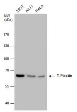 T Plastin Antibody (GT3310), Novus Biologicals 100 &mu;g | Buy Online | Novus Biologicals | Fisher Scientific