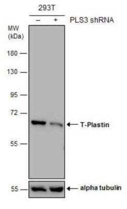 T Plastin Antibody (GT3310), Novus Biologicals 100 &mu;g | Buy Online | Novus Biologicals | Fisher Scientific