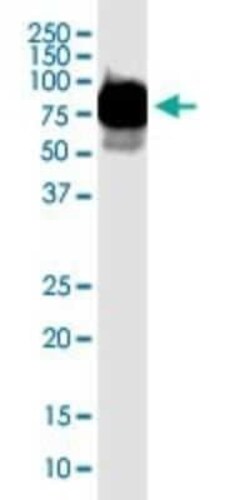 T Plastin Antibody (5B9), Novus Biologicals 0.1 mg | Buy Online | Novus Biologicals | Fisher Scientific