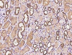 T Plastin Antibody, Novus Biologicals 100 &mu;g; Unconjugated:Antibodies,