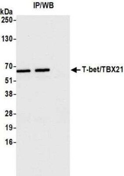 T-bet/TBX21 Antibody (BLR110H), Novus Biologicals 100 &mu;g | Buy Online | Novus Biologicals | Fisher Scientific