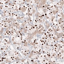 T-box 19 Antibody (CL6251), Novus Biologicals 25 &mu;L:Antibodies, Monoclonal