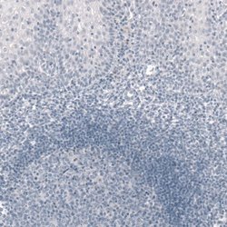 T-box 19 Antibody (CL6251), Novus Biologicals 25 &mu;L:Antibodies, Monoclonal