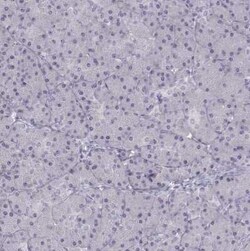 T-box 19 Antibody, Novus Biologicals 25ul; Unconjugated:Antibodies, Polyclonal