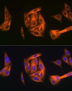 TAB1 Rabbit anti-Human, Mouse, Rat, Clone: 2W0P2, Novus Biologicals:Antibodies:Primary