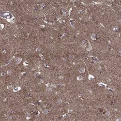 TAB2 Antibody, Novus Biologicals 25ul; Unconjugated:Antibodies, Polyclonal
