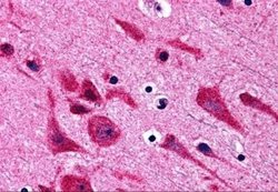 TAB2 Antibody - BSA Free, Novus Biologicals 0.1 mg; Unconjugated:Antibodies,