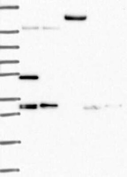 TACC1 Rabbit anti-Human, Polyclonal, Novus Biologicals 100 &mu;g; Unconjugated:Antibodies,