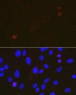 TACC3 Rabbit anti-Human, Mouse, Rat, Clone: 7S7L2, Novus Biologicals:Antibodies:Primary