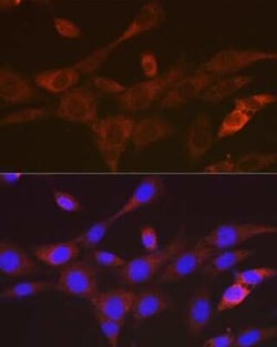 TACC3 Rabbit anti-Human, Mouse, Rat, Clone: 7S7L2, Novus Biologicals:Antibodies:Primary