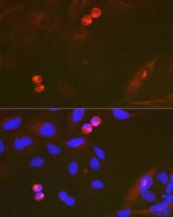 TACC3 Rabbit anti-Human, Mouse, Rat, Clone: 7S7L2, Novus Biologicals:Antibodies:Primary