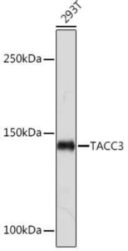 TACC3 Rabbit anti-Human, Mouse, Rat, Clone: 7S7L2, Novus Biologicals:Antibodies:Primary