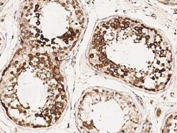 TACC3 Antibody, Novus Biologicals:Antibodies:Primary Antibodies