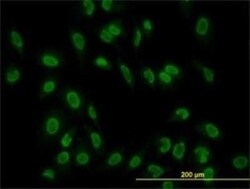 TAF11 Antibody (3D3), Novus Biologicals 0.1 mg | Buy Online | Novus Biologicals | Fisher Scientific