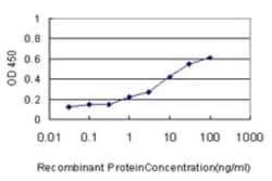 TAF148 Antibody (1F8), Novus Biologicals 0.1 mg | Buy Online | Novus Biologicals | Fisher Scientific