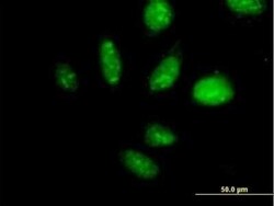 TAF1B Antibody, Novus Biologicals 0.05 mg | Buy Online | Novus Biologicals | Fisher Scientific