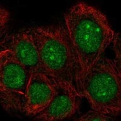 TAF1D Rabbit anti-Human, Polyclonal, Novus Biologicals 25 &mu;g; Unconjugated:Antibodies,