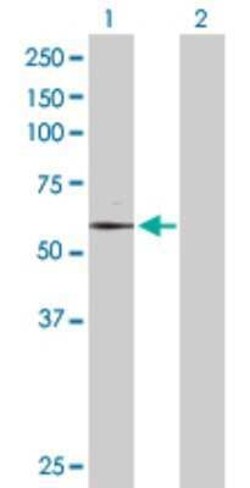 TAF6 Antibody, Novus Biologicals 0.1 mg | Buy Online | Novus Biologicals | Fisher Scientific