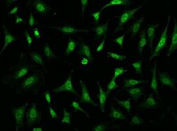TAF7L Antibody, Novus Biologicals 100 &mu;g | Buy Online | Novus Biologicals | Fisher Scientific