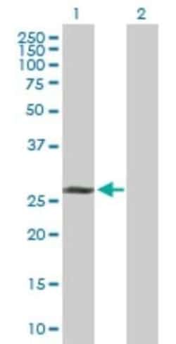 TAF9b Antibody, Novus Biologicals 0.1 mg | Buy Online | Novus Biologicals | Fisher Scientific
