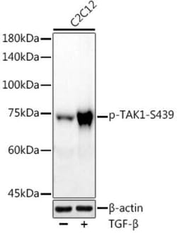 TAK1, p Ser439 Antibody (2F4V1), Novus Biologicals 100 &mu;g | Buy Online | Novus Biologicals | Fisher Scientific