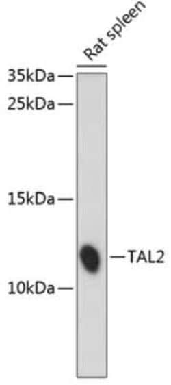 TAL2 Antibody - Azide and BSA Free, Novus Biologicals 0.02 mL; Unconjugated:Antibodies,