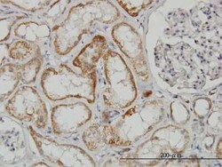 Novus Biologicals TAO2 Antibody (2E2), Novus Biologicals 100 &mu;g | Buy Online | Novus Biologicals&trade; | Fisher Scientific