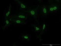 TAO2 Antibody (2F4), Novus Biologicals 0.1 mg | Buy Online | Novus Biologicals | Fisher Scientific