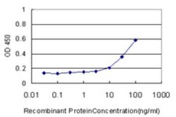 Novus Biologicals TAO2 Antibody (3E2), Novus Biologicals 50 &mu;g | Buy Online | Novus Biologicals&trade; | Fisher Scientific