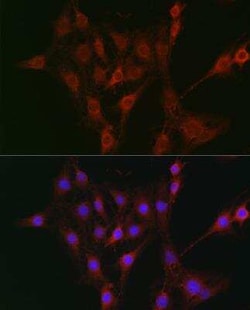 TAP2 Antibody - Azide and BSA Free, Novus Biologicals:Antibodies:Primary
