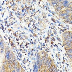 TAP2 Antibody - Azide and BSA Free, Novus Biologicals:Antibodies:Primary