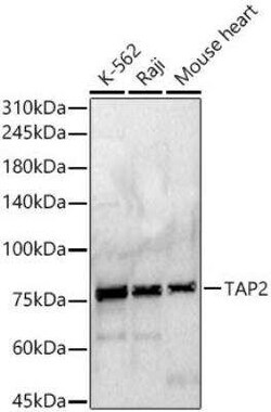 TAP2 Antibody - Azide and BSA Free, Novus Biologicals:Antibodies:Primary