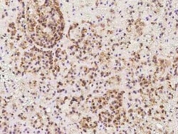 TAPT1 Antibody, Novus Biologicals 50 &mu;g, Unconjugated:Antibodies, Polyclonal
