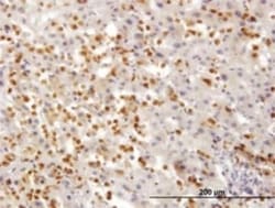 TARS Antibody (1A9), Novus Biologicals 0.1 mg | Buy Online | Novus Biologicals | Fisher Scientific