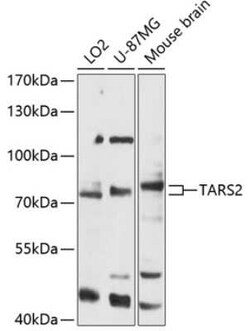 TARS2 Antibody - Azide and BSA Free, Novus Biologicals 0.1 mL, Unconjugated:Antibodies,