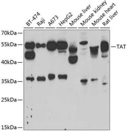 TAT Antibody - BSA Free, Novus Biologicals:Antibodies:Primary Antibodies
