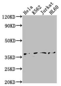 TATA binding protein TBP Antibody (3C7), Novus Biologicals 100 &mu;g; Unconjugated:Antibodies,
