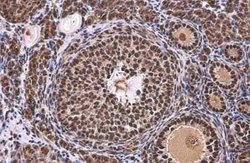 TATA binding protein TBP Antibody, Novus Biologicals 100 &mu;g | Buy Online | Novus Biologicals | Fisher Scientific