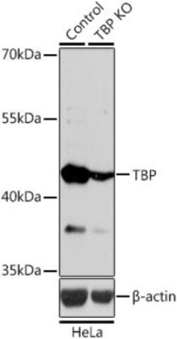 KMT1A/SUV39H1 Rabbit anti-Human, Mouse, Rat, Polyclonal, Novus Biologicals:Antibodies:Primary