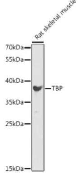 TATA binding protein TBP Antibody - BSA Free, Novus Biologicals 0.1 mL;