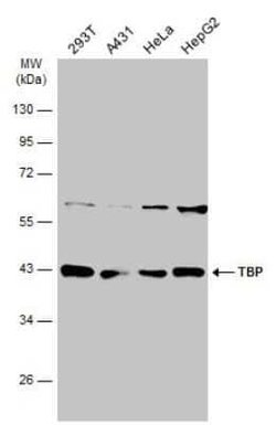 TATA binding protein TBP Antibody, Novus Biologicals 100 &mu;g | Buy Online | Novus Biologicals | Fisher Scientific