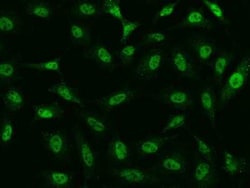 TATDN1 Antibody, Novus Biologicals 50 &mu;g, Unconjugated:Antibodies, Polyclonal