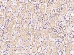 TATDN1 Antibody, Novus Biologicals 50 &mu;g, Unconjugated:Antibodies, Polyclonal