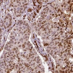 TAZ/WWTR1 Antibody (CL0371), Novus Biologicals 25 &mu;L, Unconjugated:Antibodies,