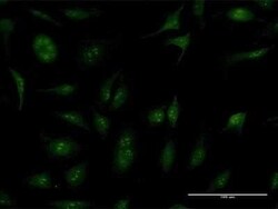 TBC1D1 Antibody, Novus Biologicals 50 &mu;g | Buy Online | Novus Biologicals | Fisher Scientific