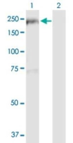 TBC1D1 Antibody, Novus Biologicals 50 &mu;g | Buy Online | Novus Biologicals | Fisher Scientific