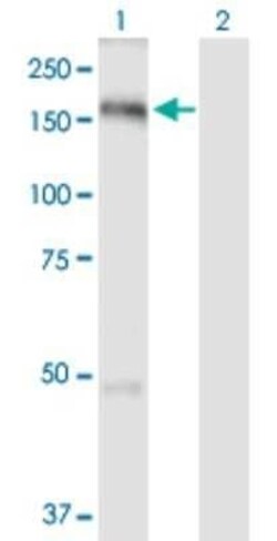 TBC1D1 Antibody, Novus Biologicals 0.1 mg | Buy Online | Novus Biologicals | Fisher Scientific